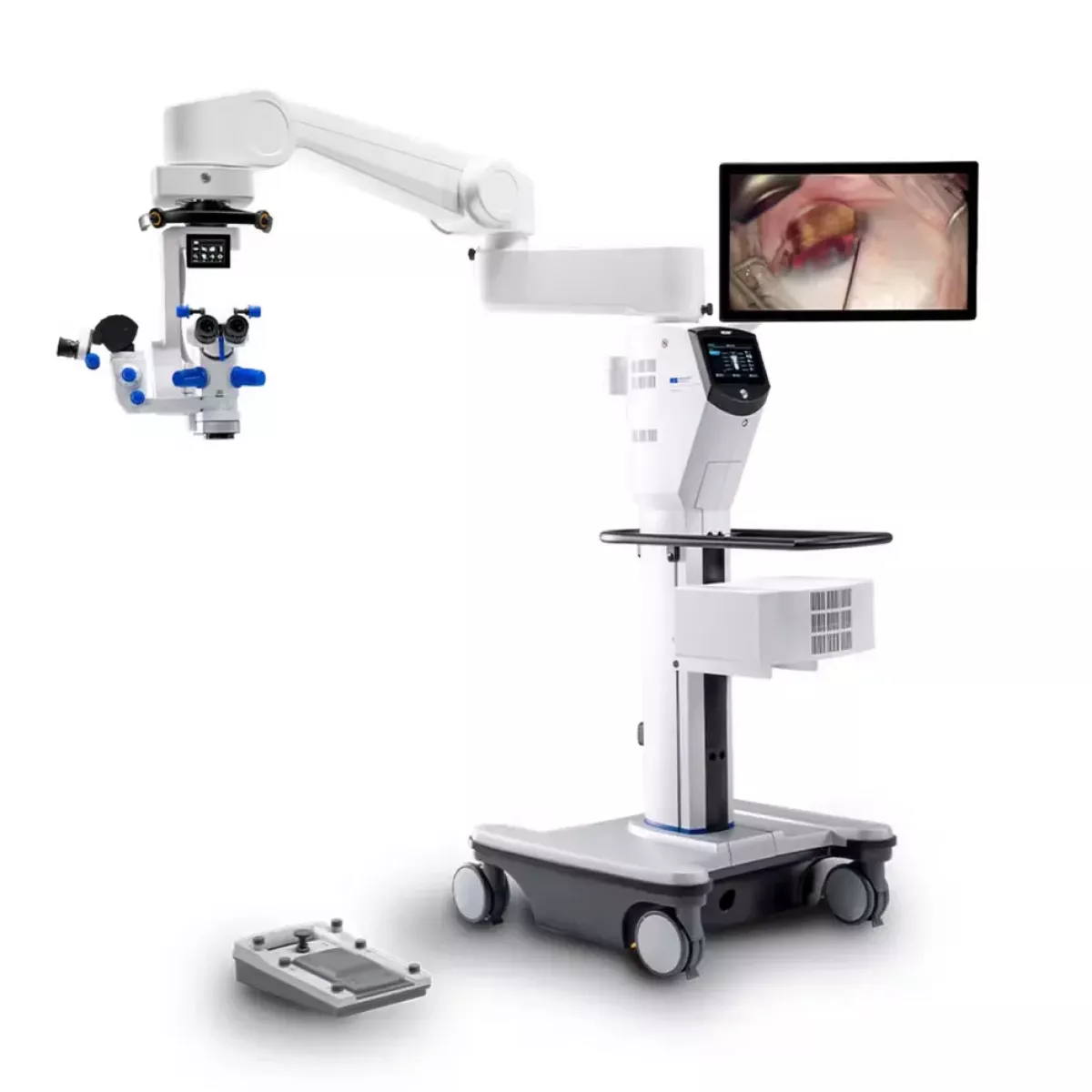 METIS 900 Нова офтальмологічна мікроскопічна система1_результат